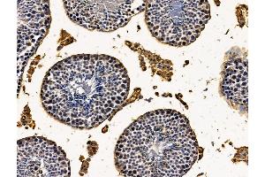 ABIN7096204 and ABIN7100266 at 1/100 staining mouse testis tissue by IHC-P.