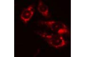 ABIN6274207 staining Hela cells by IF/ICC. (DTYMK antibody  (Internal Region))