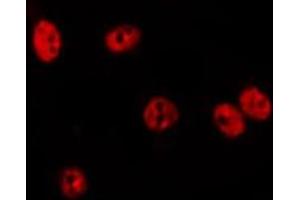 ABIN6275631 staining HepG2 by IF/ICC. (TIGD3 antibody  (Internal Region))