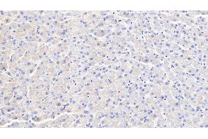 Detection of IFNg in Canine Liver Tissue using Polyclonal Antibody to Interferon Gamma (IFNg) (Interferon gamma antibody  (AA 24-166))