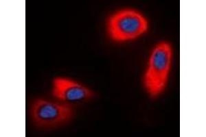 Immunofluorescent analysis of CHST9 staining in HepG2 cells.