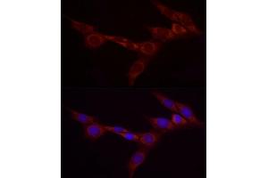 Immunofluorescence analysis of NIH/3T3 cells using Bcdin3d Rabbit pAb (ABIN7265842) at dilution of 1:25 (40x lens). (BCDIN3D antibody)