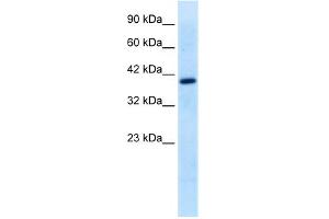 WB Suggested Anti-TFEB Antibody Titration:  0. (TFEB antibody  (Middle Region))
