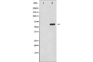 Western blot analysis of Chk2 phosphorylation expression in UV treated COS7 whole cell lysates,The lane on the left is treated with the antigen-specific peptide. (CHEK2 antibody  (pThr383))