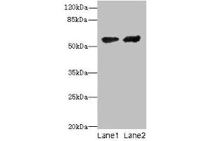 Western blot All lanes: CYP17A1 antibody at 12 μg/mL Lane 1: Hela whole cell lysate Lane 2: A549 whole cell lysate Secondary Goat polyclonal to rabbit IgG at 1/10000 dilution Predicted band size: 58 kDa Observed band size: 58 kDa (CYP17A1 antibody  (AA 24-508))