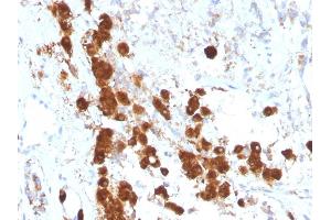 Formalin-fixed, paraffin-embedded human Pituitary stained with ACTH Monoclonal Antibody (SPM333). (POMC antibody  (AA 1-24))