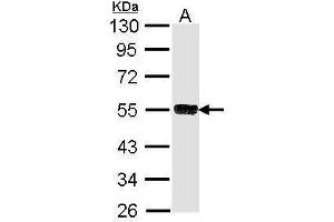 WB Image Sample (30 ug of whole cell lysate) A: Molt-4 , 10% SDS PAGE antibody diluted at 1:1000 (TRIM21 antibody)
