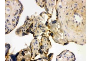 IHC analysis of YB using anti-YB antibody (ABIN3043966).