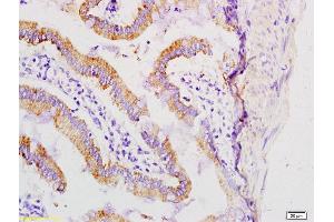 Formalin-fixed and paraffin embedded rat small intestine tissue labeled with Anti-Dermokine beta Polyclonal Antibody, Unconjugated (ABIN1386907) at 1:200 followed by conjugation to the secondary antibody (Dermokine antibody  (AA 440-455))