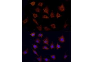 Immunofluorescence analysis of L929 using CPT1C antibody (ABIN6130131, ABIN6138980, ABIN6138981 and ABIN6217987) at dilution of 1:100. (CPT1C antibody  (AA 270-400))