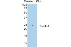 Western Blotting (WB) image for anti-Peroxidasin Homolog (PXDN) (AA 76-260) antibody (ABIN1860379)