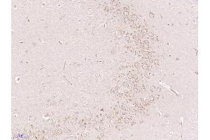 Immunohistochemistry (Paraffin-embedded Sections) (IHC (p)) image for anti-Gliomedin (GLDN) (AA 365-460) antibody (ABIN1386375)