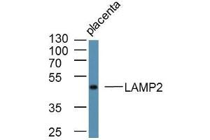 Western Blotting (WB) image for anti-Lysosomal-Associated Membrane Protein 2 (LAMP2) (AA 301-411) antibody (ABIN680198)