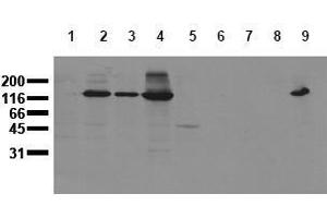 Western Blotting (WB) image for anti-Cadherin 2 (CDH2) antibody (ABIN126737) (N-Cadherin antibody)