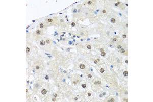 Immunohistochemistry (Paraffin-embedded Sections) (IHC (p)) image for anti-Ubiquitin C (UBC) (AA 1-100) antibody (ABIN1683190)