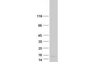 Validation with Western Blot (Pyrin Domain Containing 2 (PYDC2) protein (Myc-DYKDDDDK Tag))