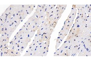 Detection of SEMA5B in Mouse Cardiac Muscle Tissue using Polyclonal Antibody to Semaphorin 5B (SEMA5B) (SEMA5B antibody  (AA 836-1013))