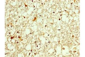 IHC image of ABIN7155839 diluted at 1:250 and staining in paraffin-embedded human brain tissue performed on a Leica BondTM system. (OTX2 antibody  (AA 1-297))