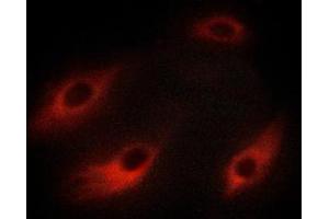 Immunofluorescence (fixed cells) (IF/ICC) image for anti-Heat Shock Protein, alpha-Crystallin-Related, B6 (HSPB6) (pSer16) antibody (ABIN6256161)