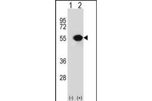 Western blot analysis of RUVBL1 (arrow) using rabbit polyclonal RUVBL1 Antibody (ABIN650671 and ABIN2838241). (RUVBL1 antibody)