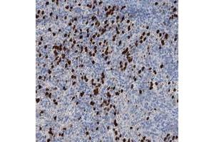 Immunohistochemical staining of human spleen with OTOA polyclonal antibody  shows strong cytoplasmic positivity in cells of red pulp at 1:50-1:200 dilution.