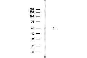 anti-ADP-Ribosylation Factor GTPase Activating Protein 1 (ARFGAP1) (Internal Region) antibody
