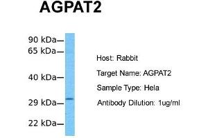 Host:  Rabbit  Target Name:  AGPAT2  Sample Tissue:  Human Hela  Antibody Dilution:  1. (AGPAT2 antibody  (C-Term))