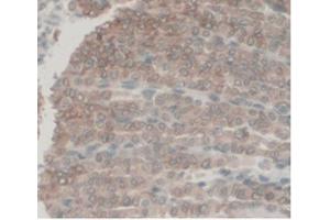IHC-P analysis of Mouse Stomach Tissue, with DAB staining. (C5A antibody  (AA 679-755))