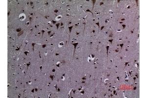 Immunohistochemical analysis of paraffin-embedded human-brain, antibody was diluted at 1:100. (HSP90 antibody  (acLys284, acLys292))
