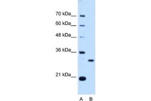 Western Blotting (WB) image for anti-PSME3 (PSME3) antibody (ABIN2462948)