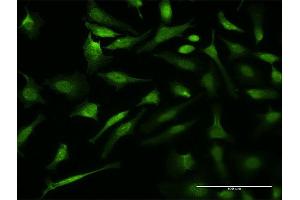 Immunofluorescence of monoclonal antibody to VCP on HeLa cell. (VCP antibody  (AA 221-310))