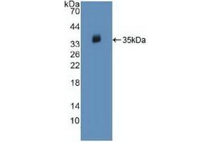 Detection of Recombinant JAK2, Human using Polyclonal Antibody to Janus Kinase 2 (JAK2) (JAK2 antibody  (AA 508-800))