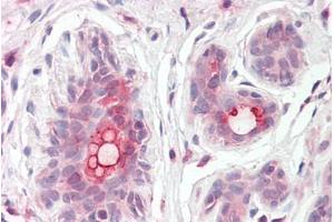 ABIN302164 (3. (ABCC11 antibody  (Internal Region))