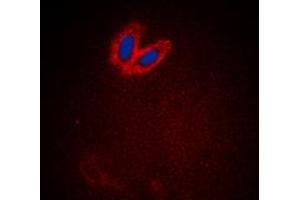 Immunofluorescent analysis of ACK1 (pY284) staining in HeLa cells. (TNK2 antibody  (pTyr284))