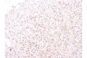 Immunohistochemistry (IHC) image for anti-Minichromosome Maintenance Deficient 4 (MCM4) (AA 325-375) antibody (ABIN7449391) (MCM4 antibody  (AA 325-375))