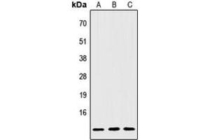 Western blot analysis of IGFL2 expression in Jurkat (A), NIH3T3 (B), H9C2 (C) whole cell lysates. (IGFL2 antibody  (Center))