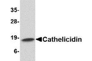 Western blot analysis of Cathelicidin in Human spleen tissue lysate with AP30207PU-N Cathelicidin antibody at 1 μg/ml. (Cathelicidin antibody  (C-Term))