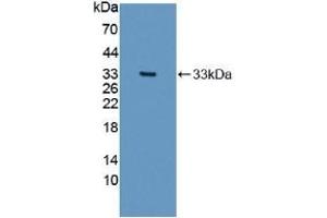 Detection of Recombinant COL1a2, Human using Polyclonal Antibody to Collagen Type I Alpha 2 (COL1a2) (COL1A2 antibody  (AA 1103-1366))
