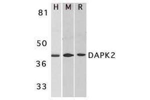 Western blot analysis of DAPK2 in A431 (H), mouse spleen (M), and rat kidney (R) lysates with DAPK2 antibody at 1μg/ml. (DAPK2 antibody  (AA 356-370))