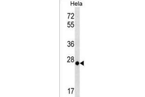 MT-CO3 Antibody (N-term) (ABIN1539412 and ABIN2838144) western blot analysis in Hela cell line lysates (35 μg/lane). (COX3 antibody  (N-Term))