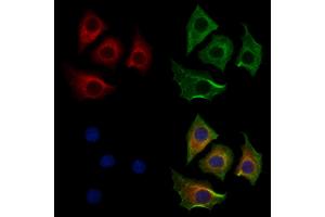 ABIN7094293 and ABIN7098340 staining HepG2 cells by IF/ICC.