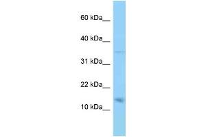 WB Suggested Anti-PMP22 Antibody Titration: 1. (PMP22 antibody  (N-Term))