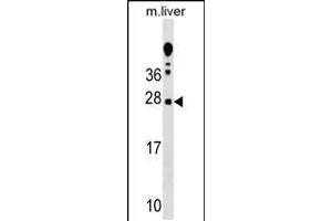 Western blot analysis in mouse liver tissue lysates (35ug/lane). (TRIM antibody  (AA 98-127))