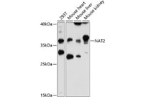 Western blot analysis of extracts of various cell lines, using N antibody (ABIN6132387, ABIN6144378, ABIN6144379 and ABIN6216511) at 1:3000 dilution. (NAT2 antibody  (AA 171-290))