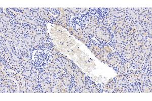 Detection of GPC4 in Human Kidney Tissue using Polyclonal Antibody to Glypican 4 (GPC4) (GPC4 antibody  (AA 261-527))