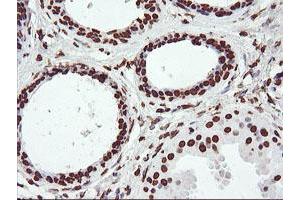 Immunohistochemical staining of paraffin-embedded Human breast tissue using anti-FBXO21 mouse monoclonal antibody. (FBXO21 antibody)