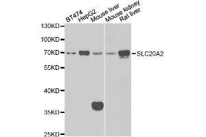 Western blot analysis of extracts of various cell lines, using SLC20A2 antibody. (SLC20A2 antibody  (AA 235-485))