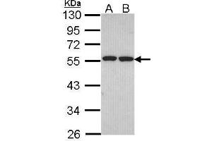 WB Image Sample (30 ug of whole cell lysate) A: H1299 B: Hela 10% SDS PAGE antibody diluted at 1:1000 (FAF2 antibody  (C-Term))
