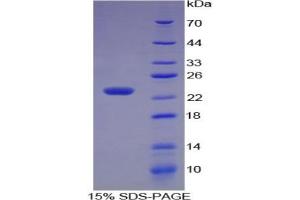 SDS-PAGE of Protein Standard from the Kit (Highly purified E. (MMP3 CLIA Kit)