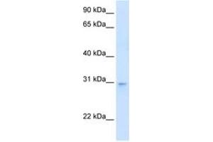 Image no. 1 for anti-LIM Domain Binding 3 (LDB3) (AA 101-150) antibody (ABIN204971)